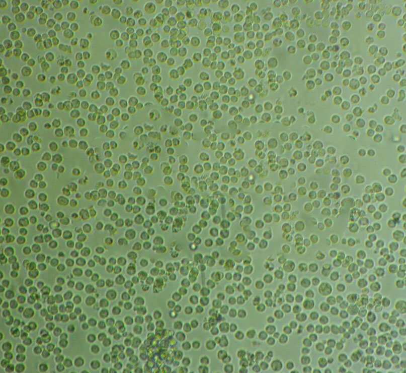 HDLM-2 cell line人霍奇金淋巴瘤细胞系