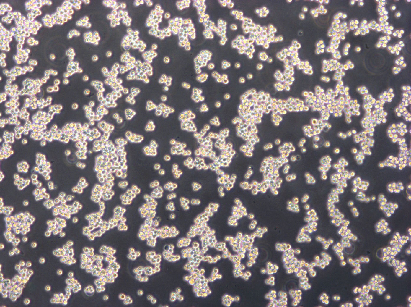 OCI-Ly19 cell line人弥漫大B淋巴瘤细胞系