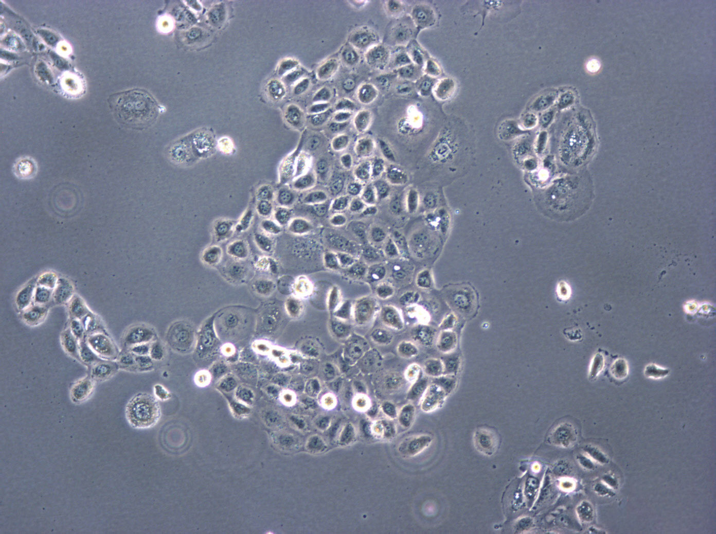 HuNS1 cell line人多发性骨髓瘤细胞系