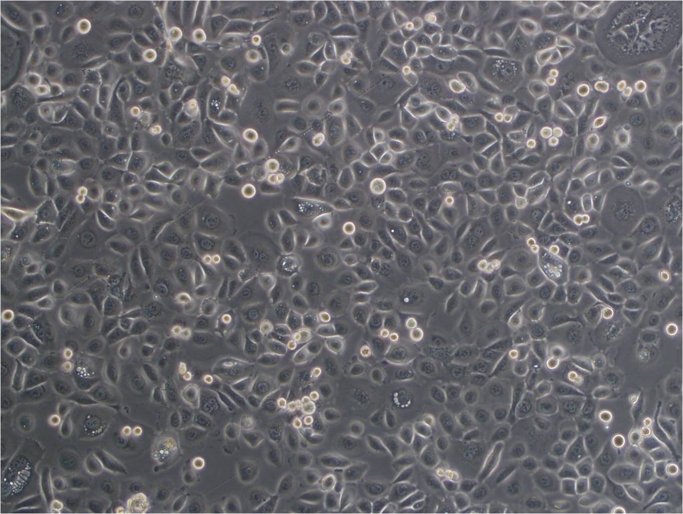 SW962 cell line人阴户鳞癌细胞系