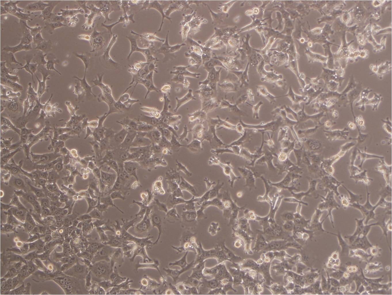 Ca9-22 cell line人口腔上皮癌细胞系