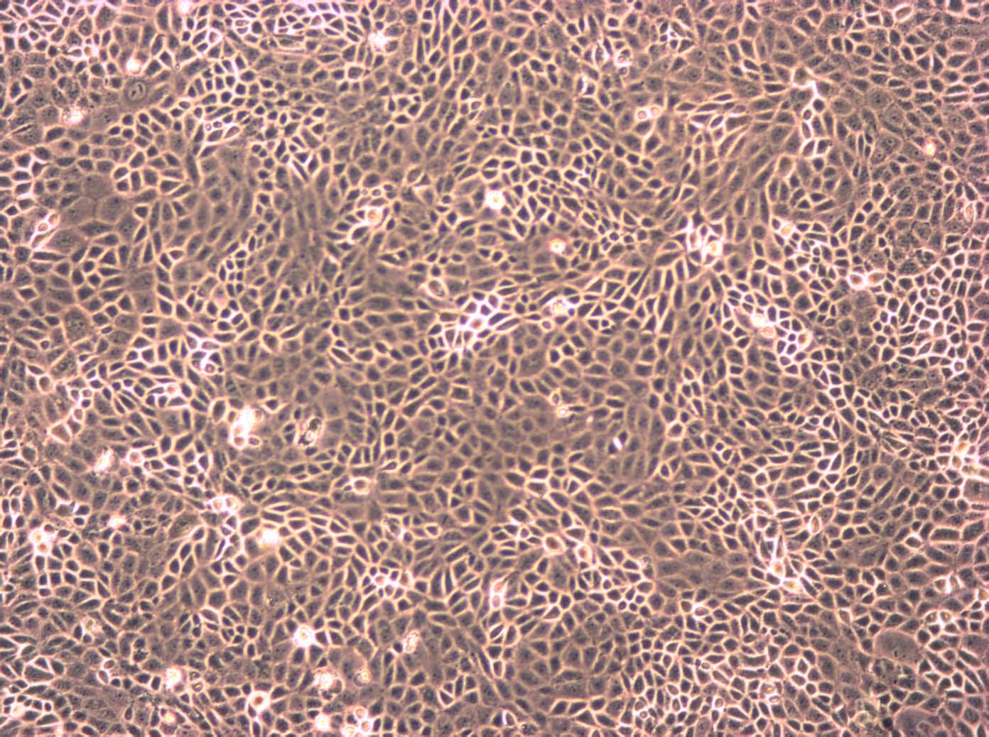 NCI-H1975 人肺腺癌细胞系