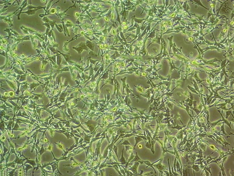 SCC-15 人鳞状细胞癌细胞系