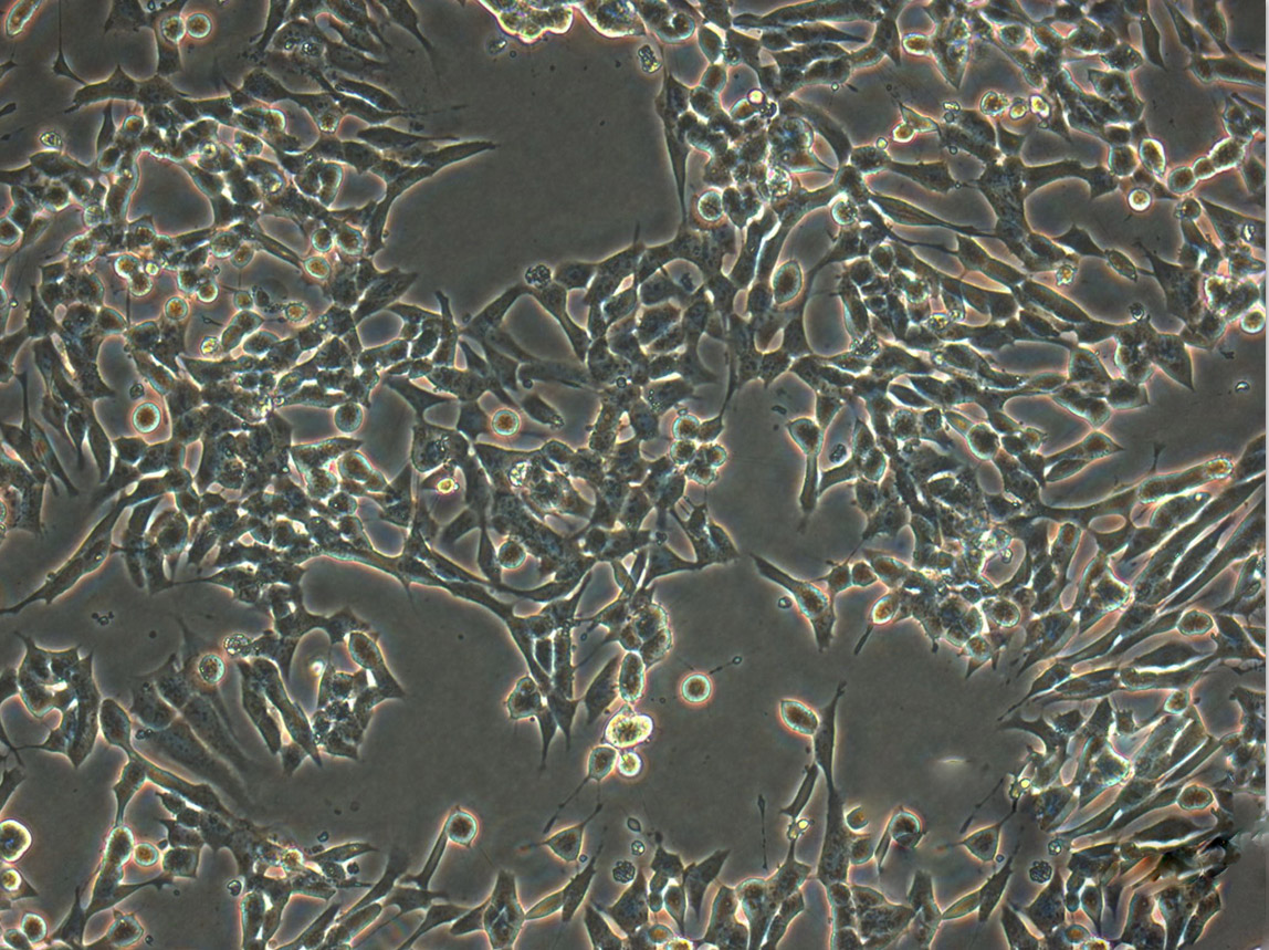 NCM356 cell line结直肠腺癌细胞系