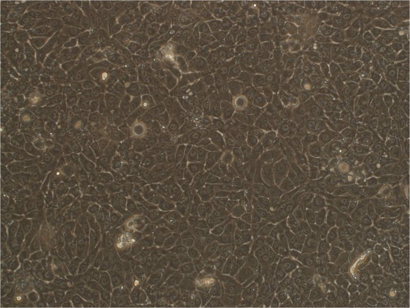 ECC10 cell line人子宫内膜癌细胞系