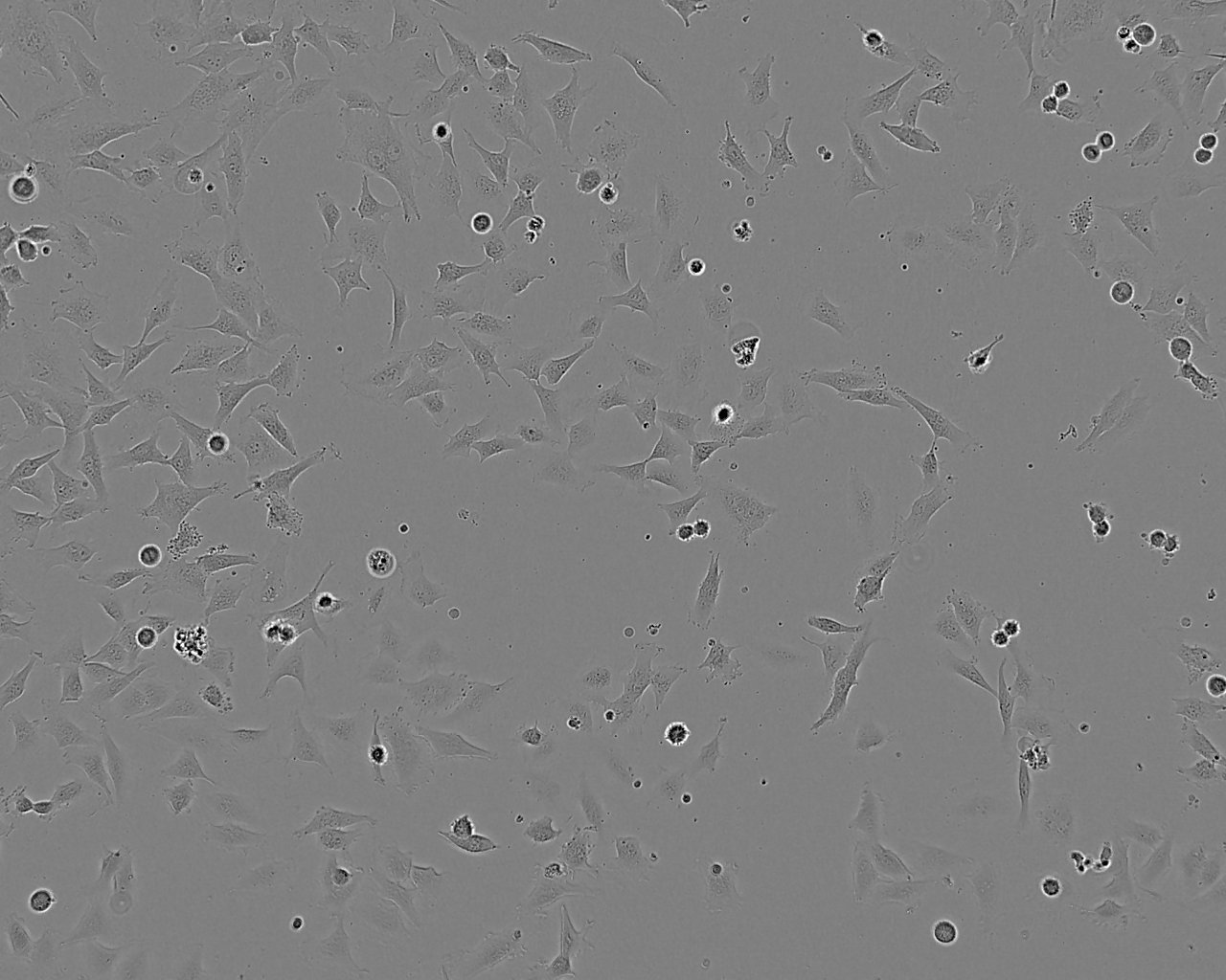 CCD-1095Sk 人乳腺浸润性导管癌旁皮肤细胞系