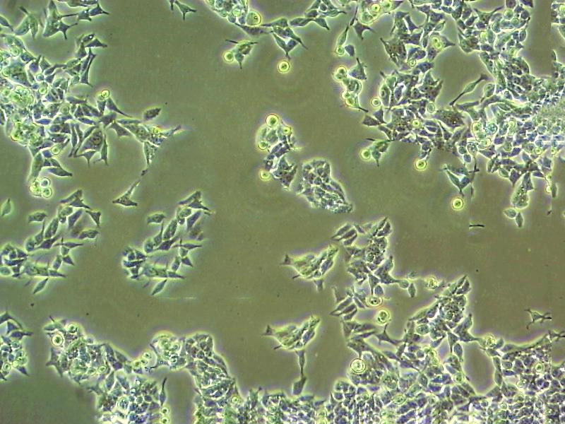 UPCI-SCC-090 人口腔鳞癌细胞系