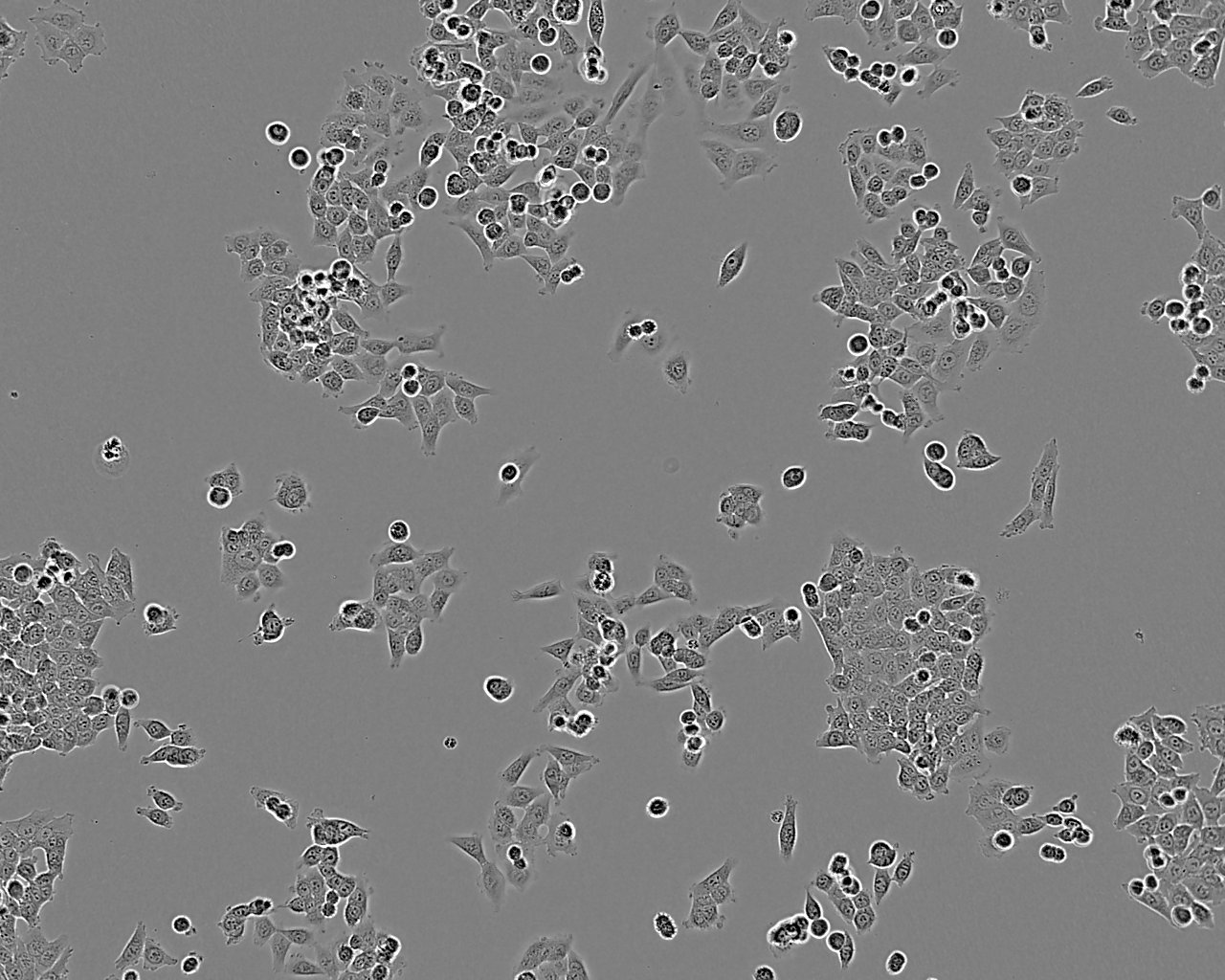 LUDLU-1 人肺癌鳞癌细胞系