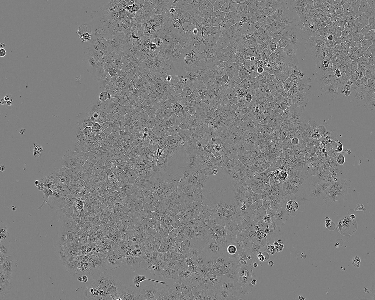 HDQ-P1 人乳腺癌细胞系