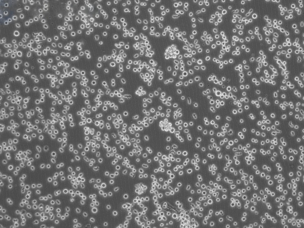 OCI-Ly3 人弥漫大B细胞淋巴瘤细胞系