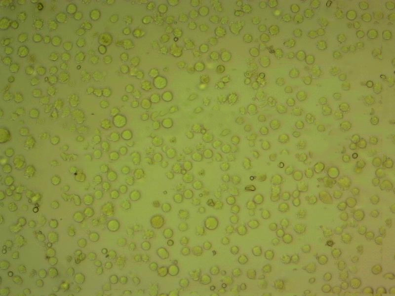 HDLM-2 人霍奇金淋巴瘤细胞系