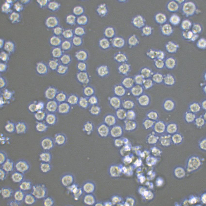 WSU-DLCL2 人弥漫大B淋巴瘤细胞系