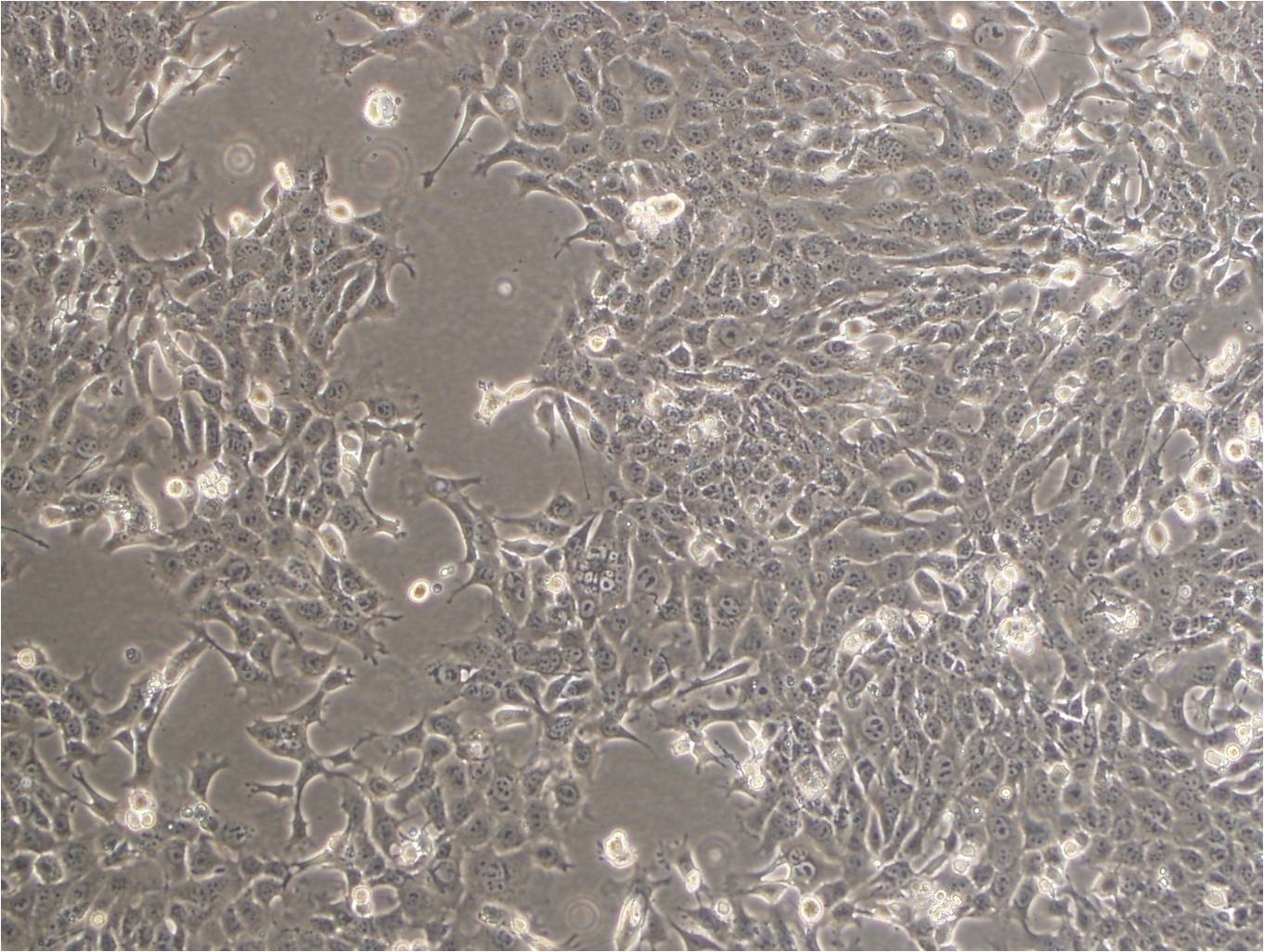 VMM39 cell line人黑色素瘤细胞系