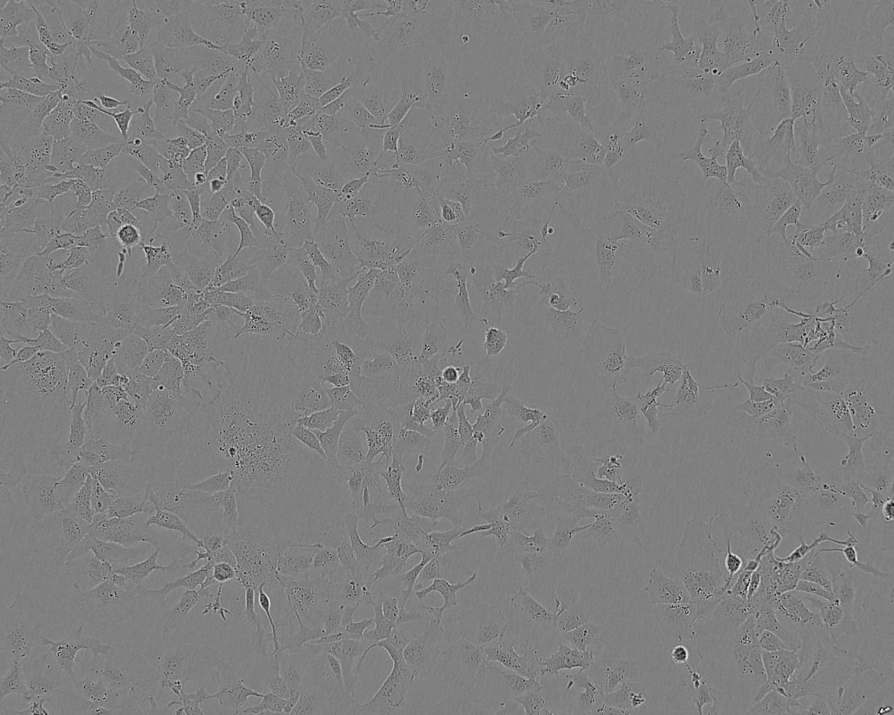 HCC-44细胞：人肺癌细胞系