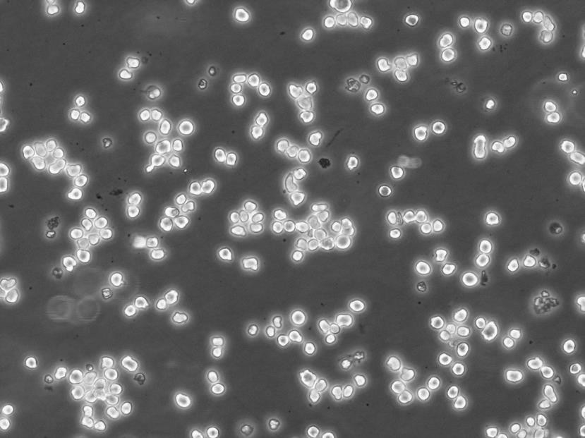 OCI-Ly19细胞：人弥漫大B淋巴瘤细胞系