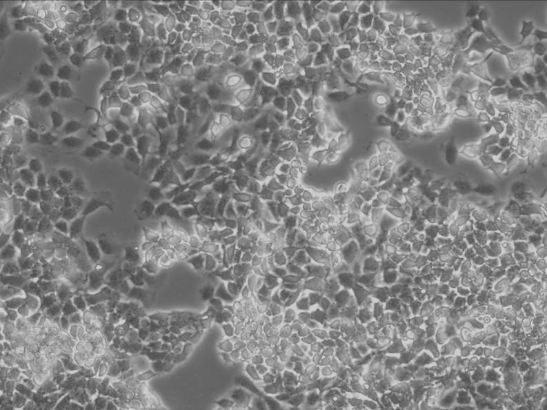 HCC1187 Cells|人乳腺导管癌细胞系