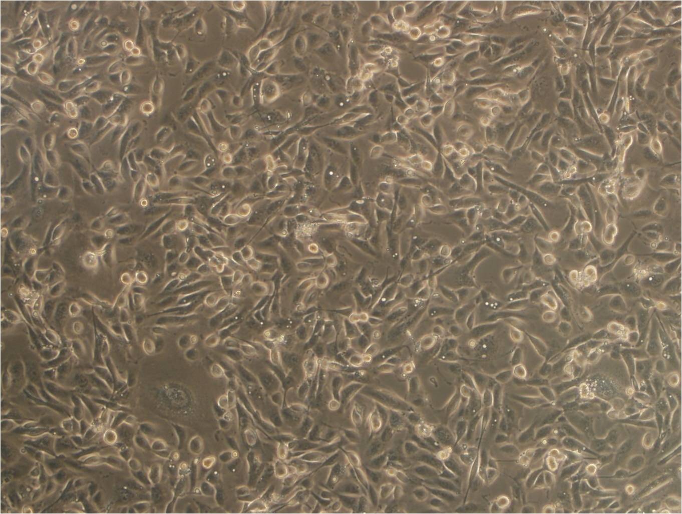 AZ-521 Cells|人胃癌细胞系