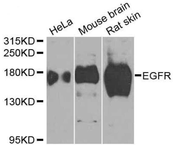 Anti-EGFR Antibody