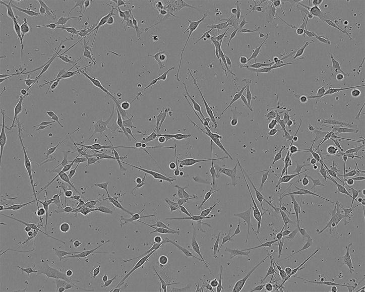 HUVEC-C[HUVEC] Cells|人脐静脉血管内皮细胞系