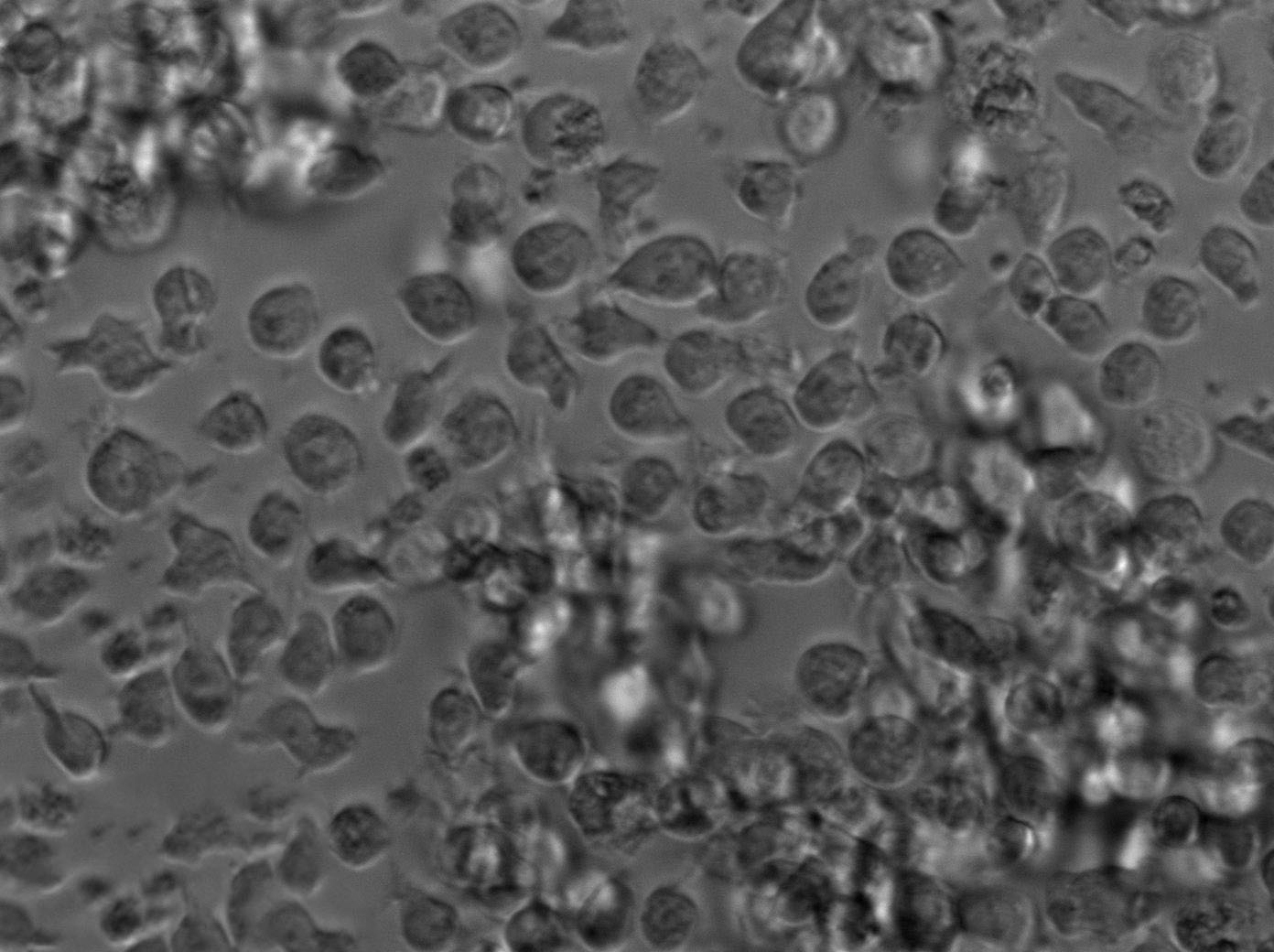 AML-193 Cell|人急性单核细胞白血病单核细胞