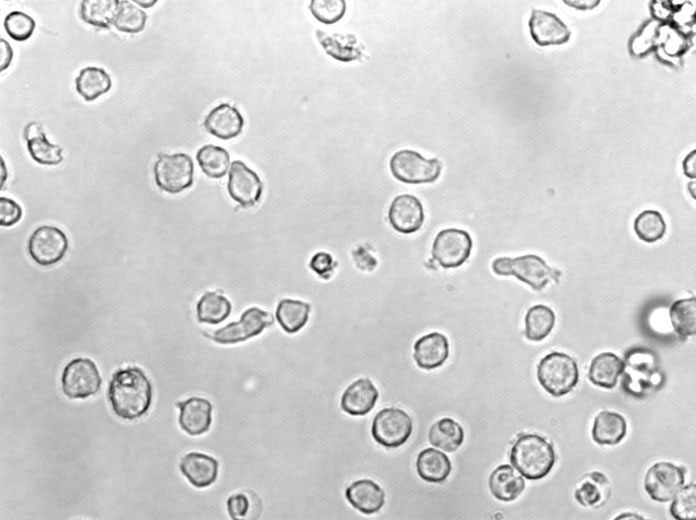 DB Cell|人淋巴瘤细胞