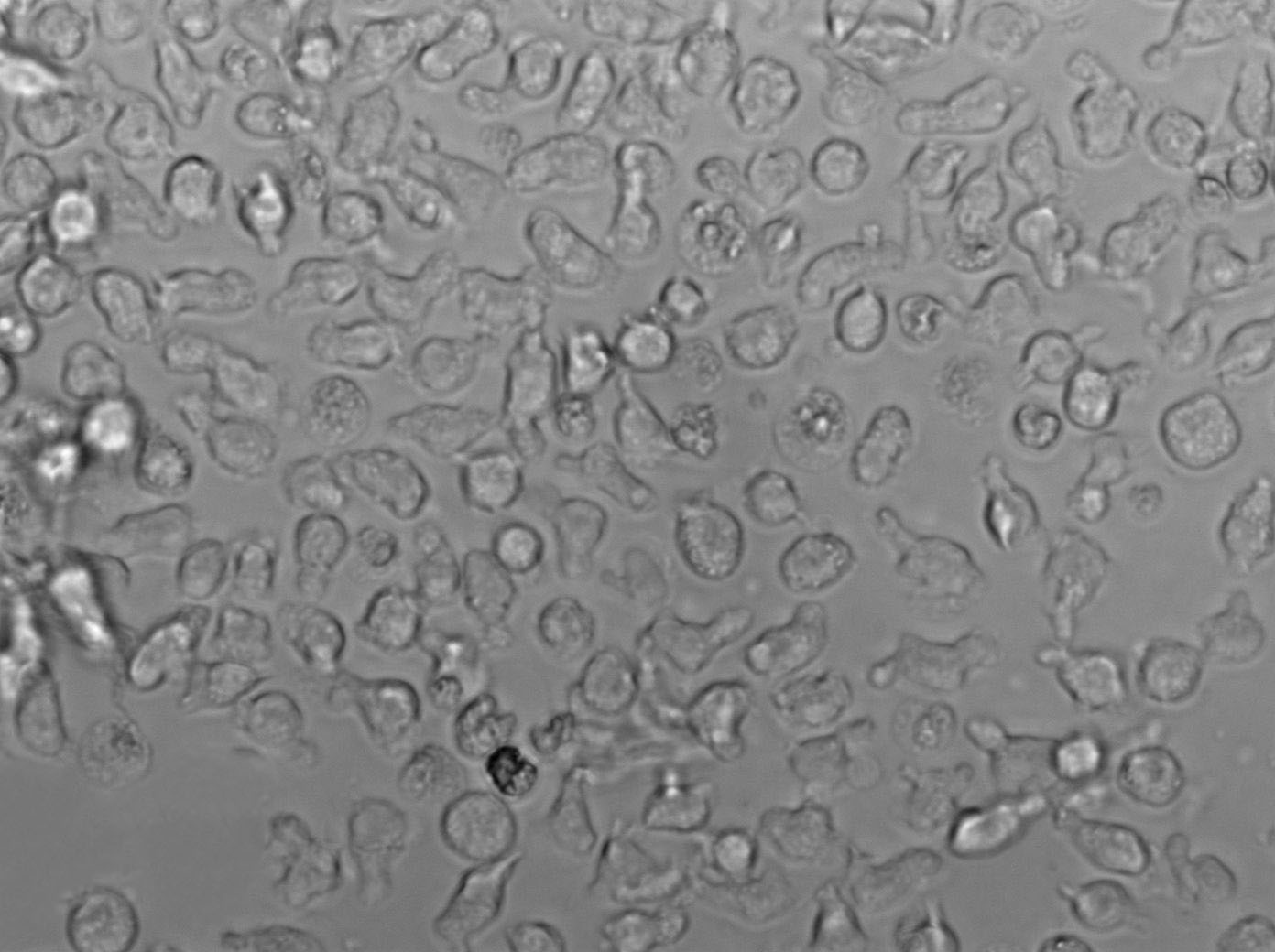 RL Cell|人非霍奇金淋巴瘤细胞