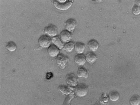 P30/OHK Cell|人急性淋巴白血病细胞