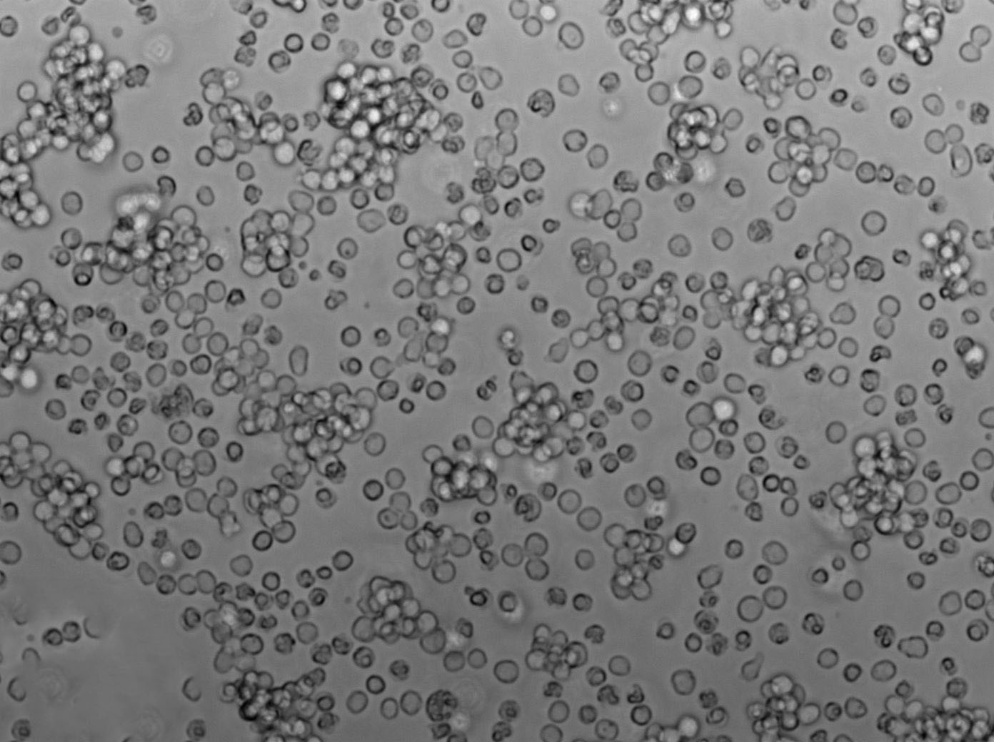 SU-DHL-10 Cell|人B细胞淋巴瘤细胞