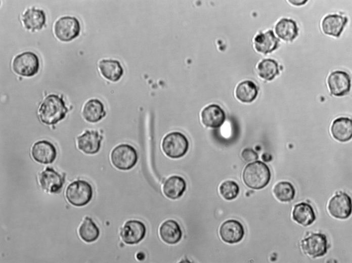 SNK-6 Cell|人NK/T细胞淋巴瘤细胞