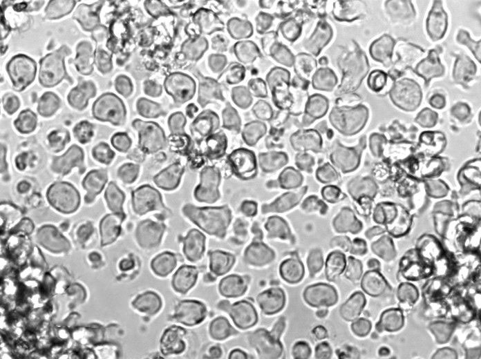 SU-DHL-2 Cell|人弥漫性大细胞淋巴瘤细胞