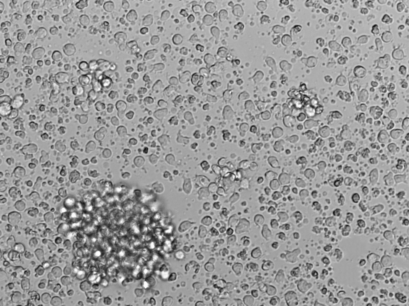 U-2932 Cell|人弥漫大B淋巴瘤细胞