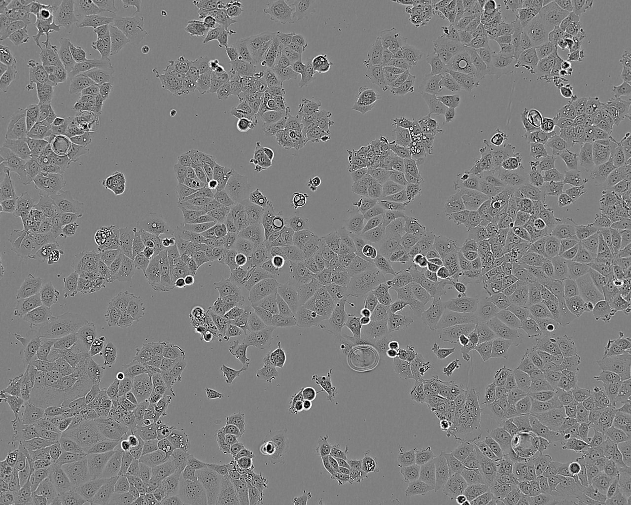 NCI-H1755 Cell|人肺癌细胞