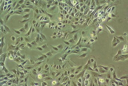 HuNS1 Cell|人多发性骨髓瘤细胞