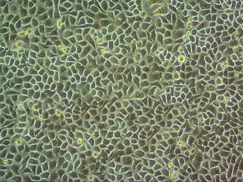 PSN1 Cell|人胰腺癌细胞