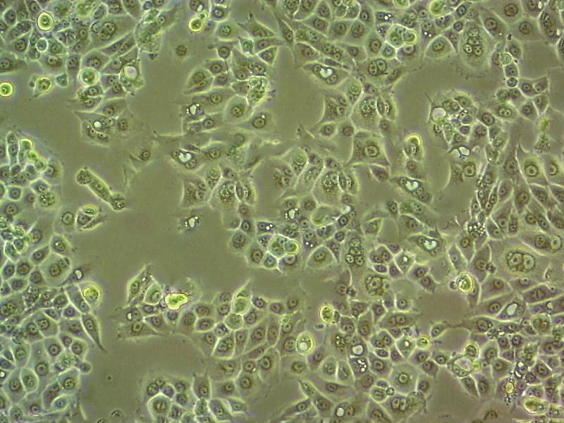 HeLa S3 Cell|人宫颈癌细胞