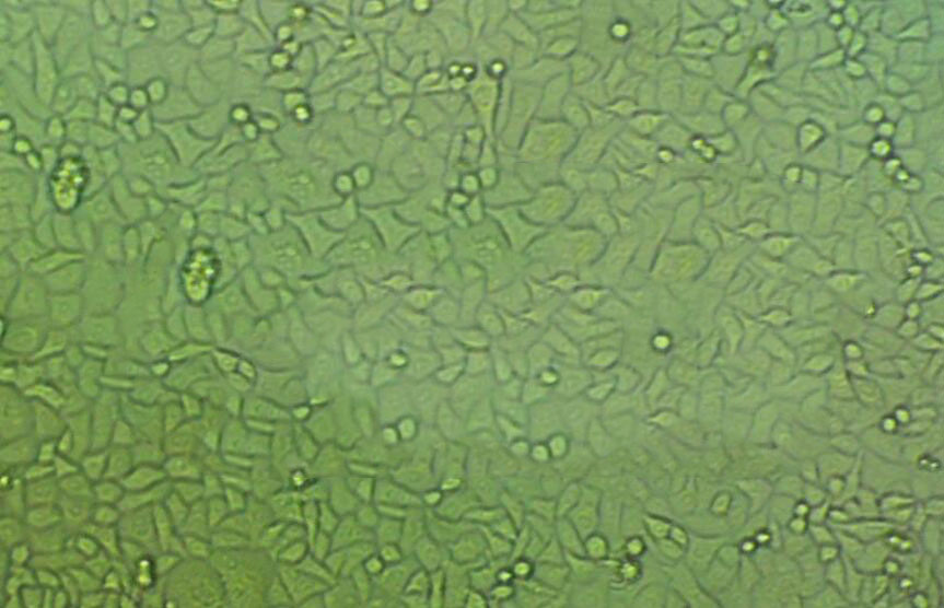 TE-15 Cell|人食管癌细胞