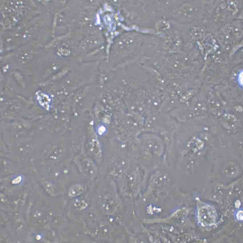 TGW Cell|人神经母细胞瘤细胞