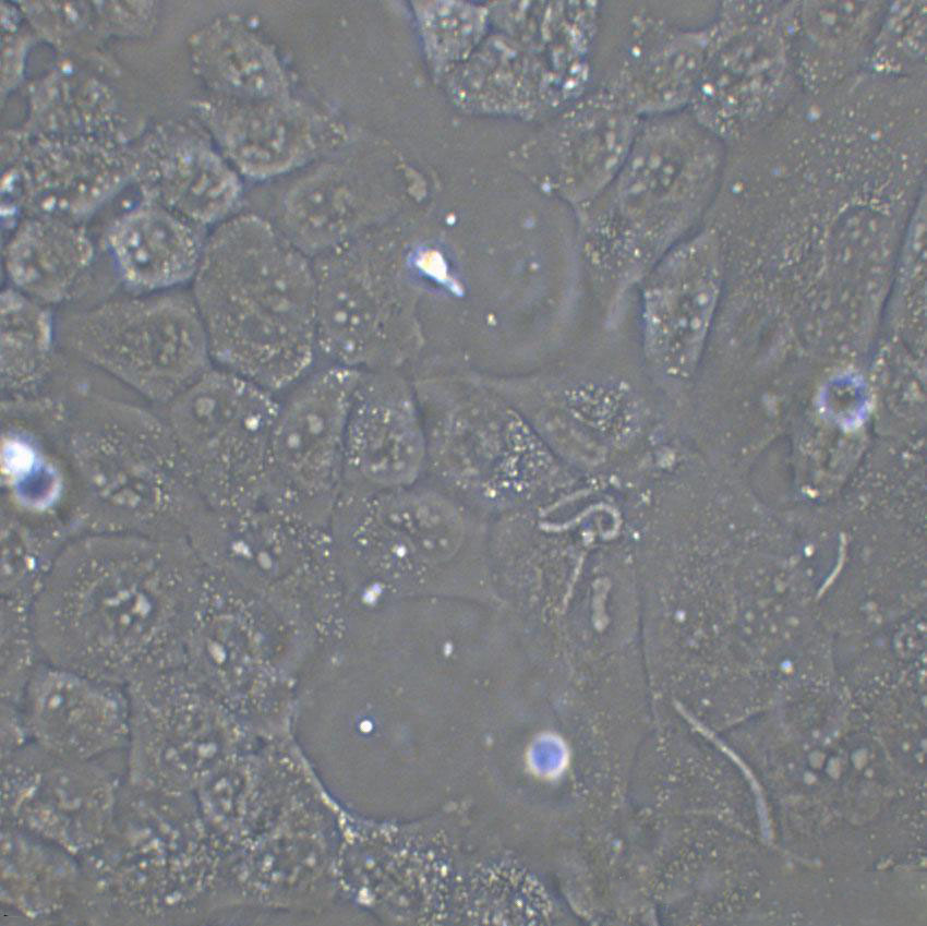 COLO 684 Cell|人子宫腺癌细胞