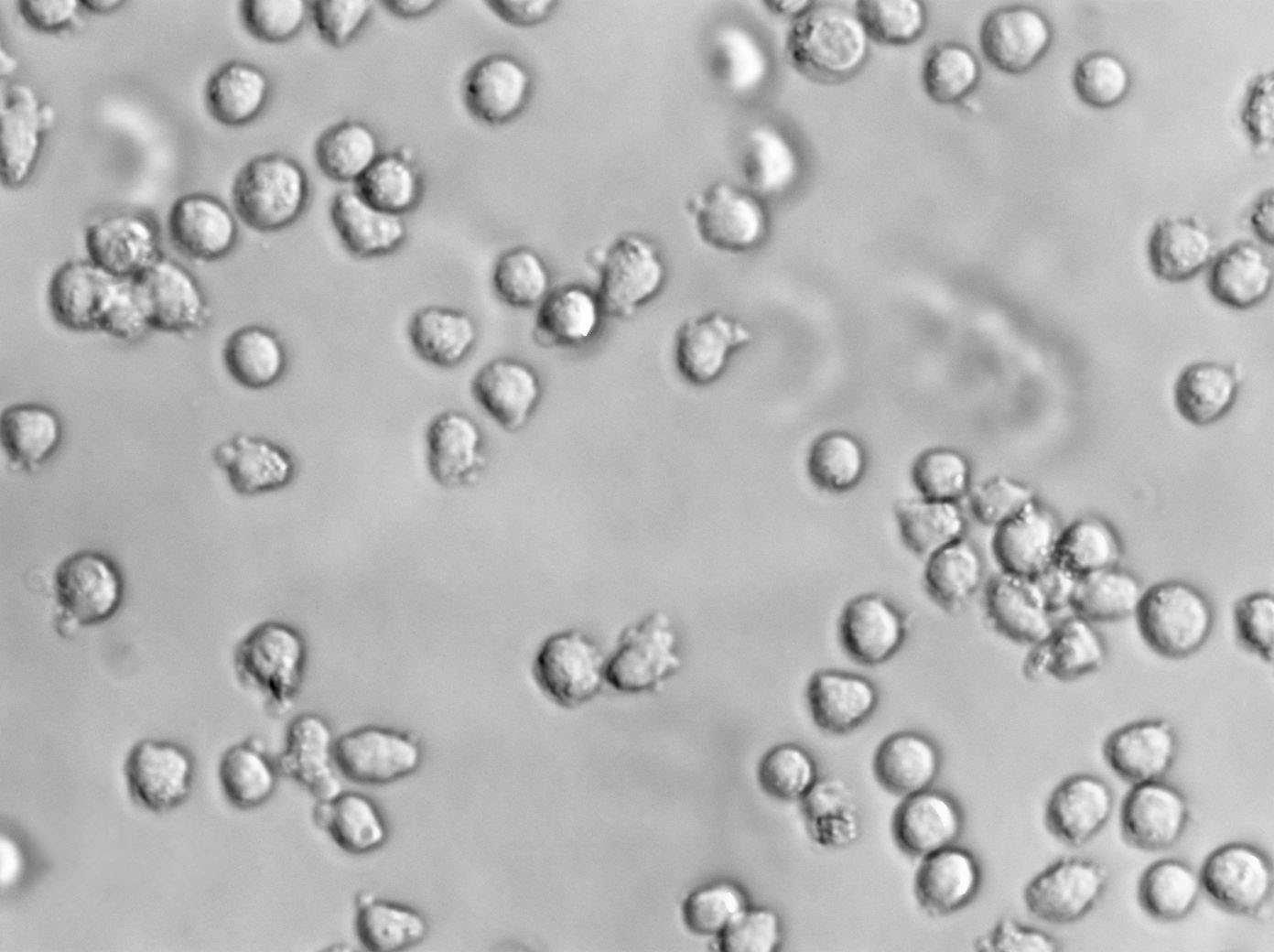 NCI-BL1339 Cell Lines:人B淋巴细胞(STR认证)