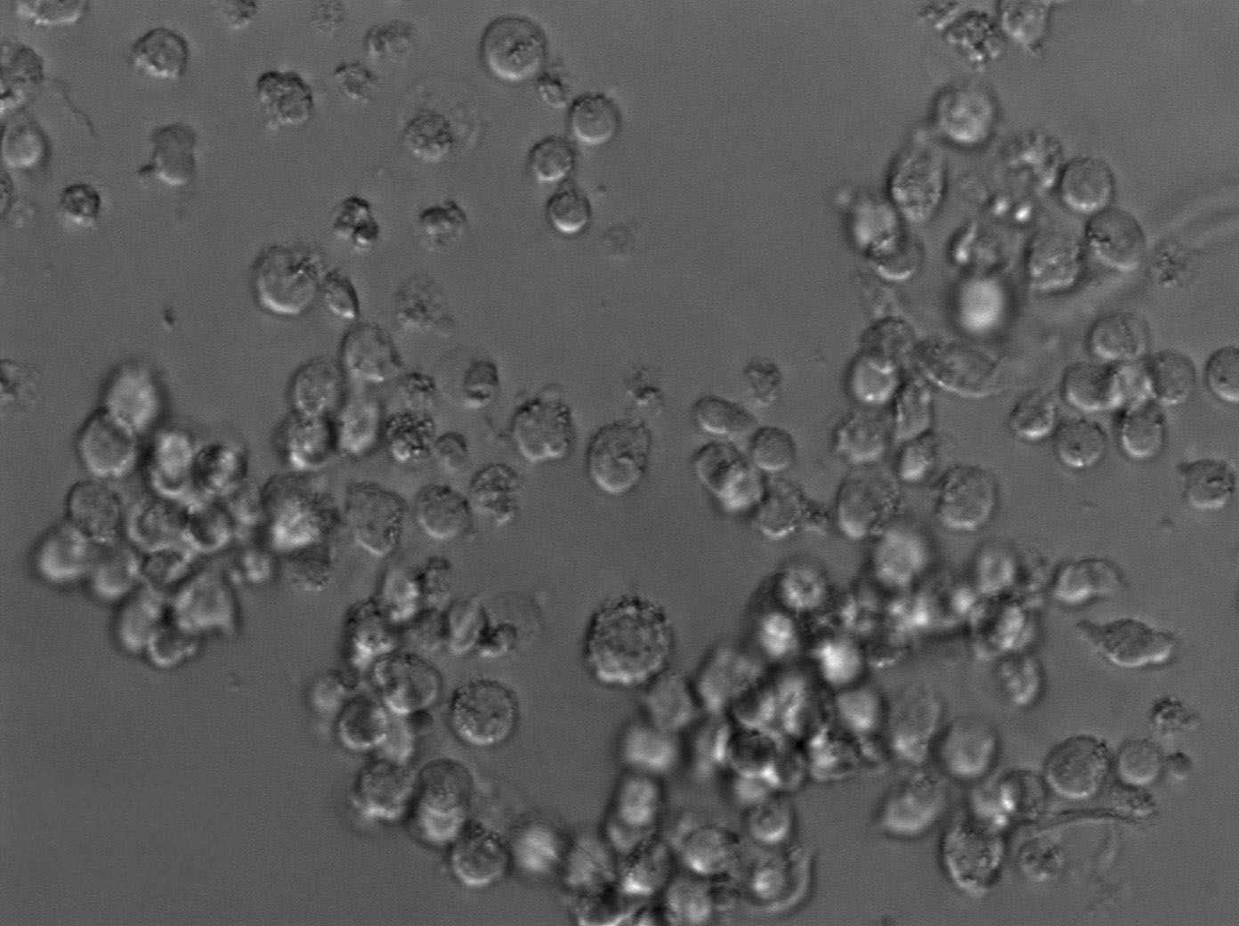 Karpas-422 Cell Lines:人类B细胞淋巴瘤细胞(STR认证)