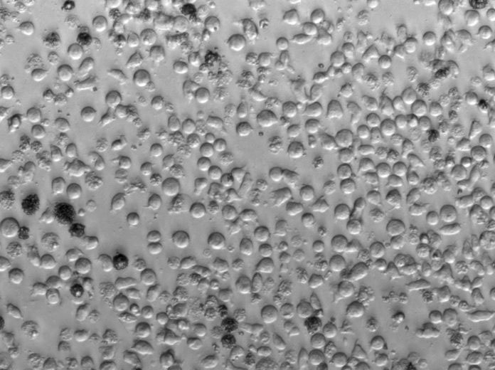 OCI-Ly18 Cell Lines:人弥漫大B细胞淋巴瘤细胞(STR认证)