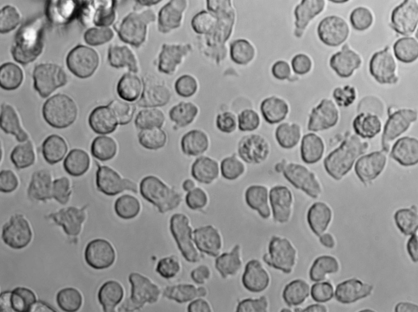 OCI-Ly19 Cell Lines:人弥漫大B淋巴瘤细胞(STR认证)