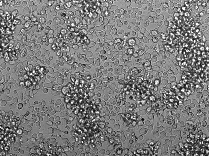 L-428 Cell Lines:人霍奇金淋巴瘤细胞(STR认证)