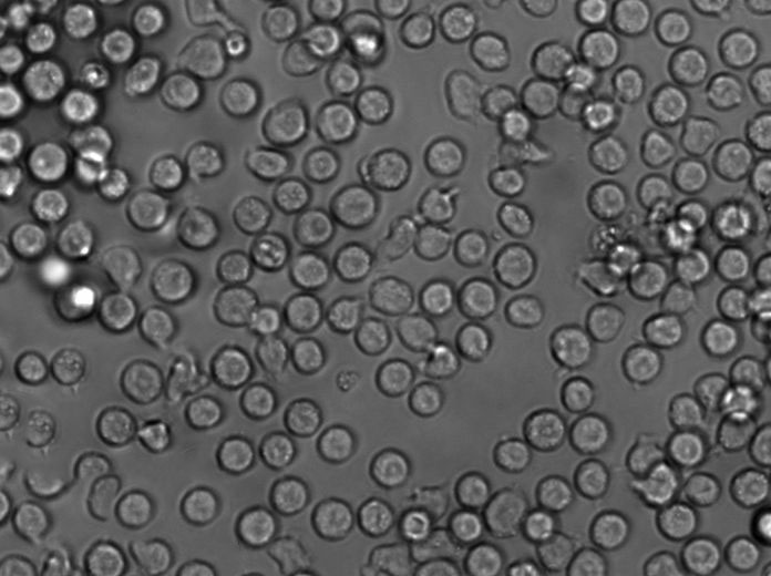 Ramos Cell Lines:人B淋巴细胞(STR认证)