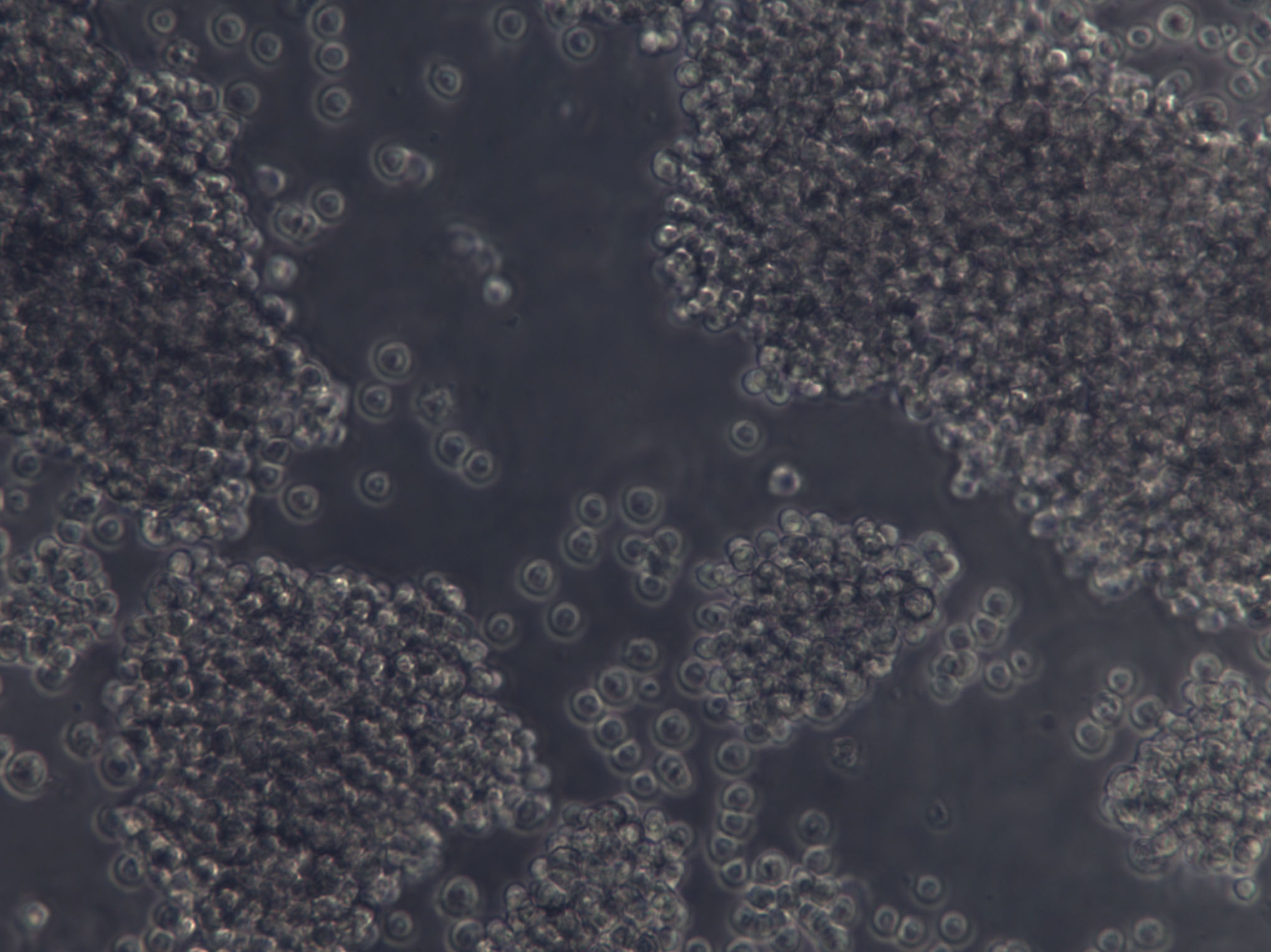 YT Cell Lines:人NK细胞白血病细胞(STR认证)