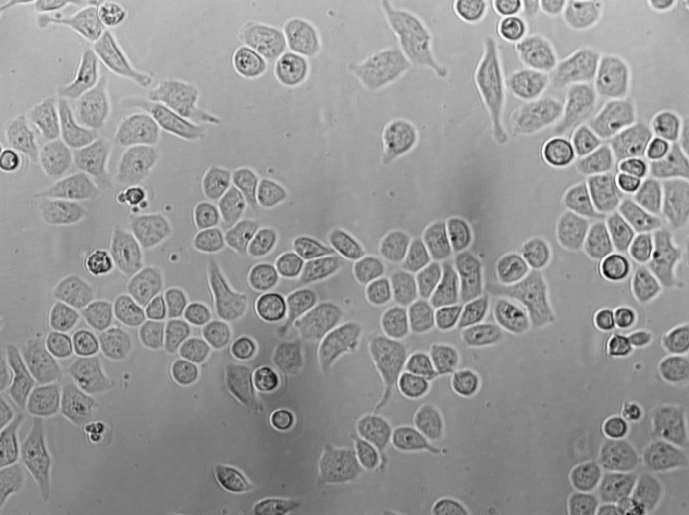 Panc02 Cell|小鼠胰腺癌细胞