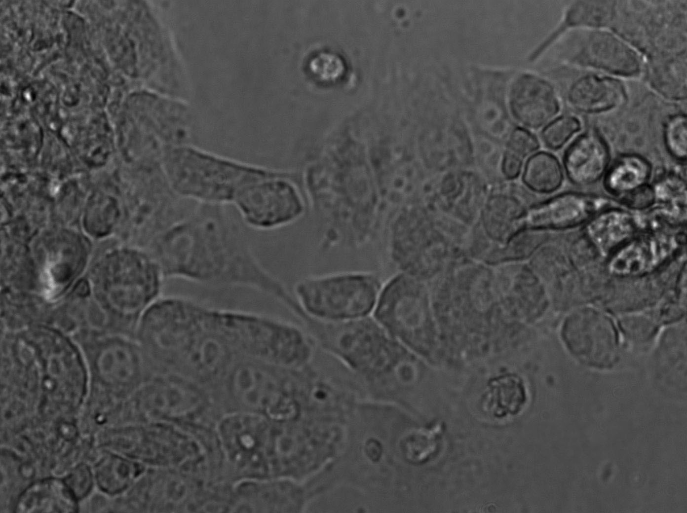 SW839 Cell|人肾癌细胞