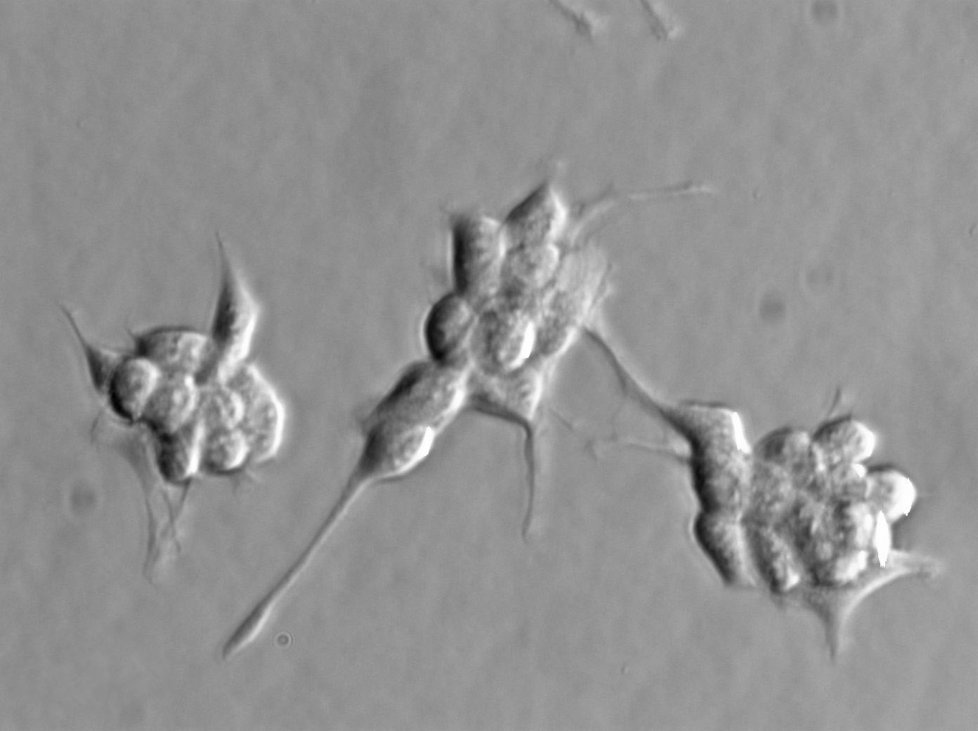 MKN45 Cell|人胃癌细胞