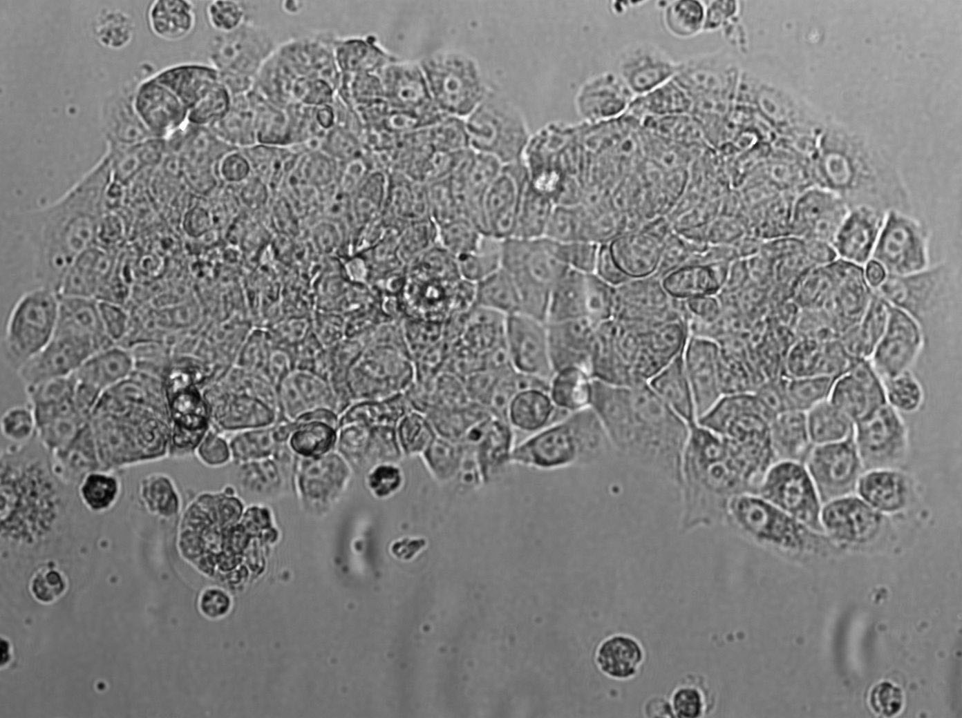 VMM39 Cell|人黑色素瘤细胞