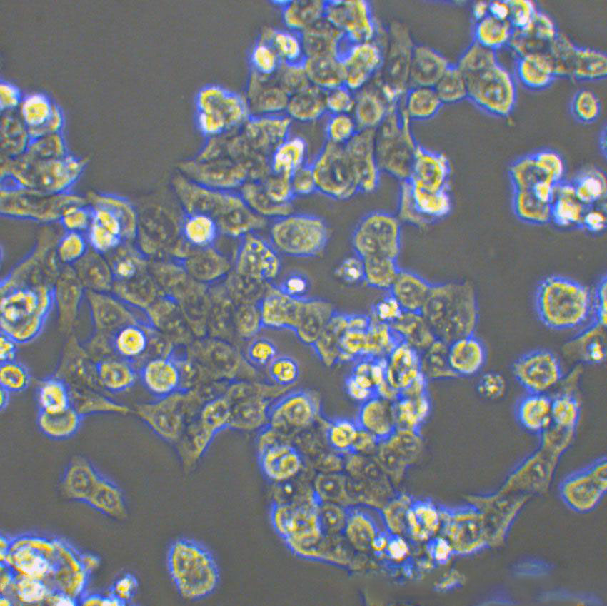 MKN74 Cell|人胃癌细胞